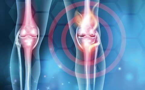 Il ruolo della terapia enzimatica nell’osteoartrosi al ginocchio